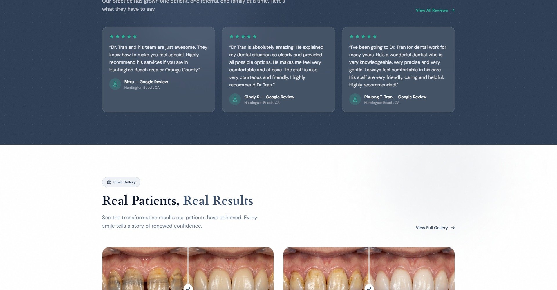 Before/after smile gallery